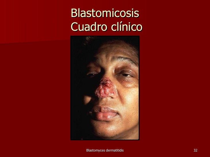 Caso clinico atropina pdf writer